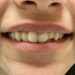 Home srishti chopra pre before